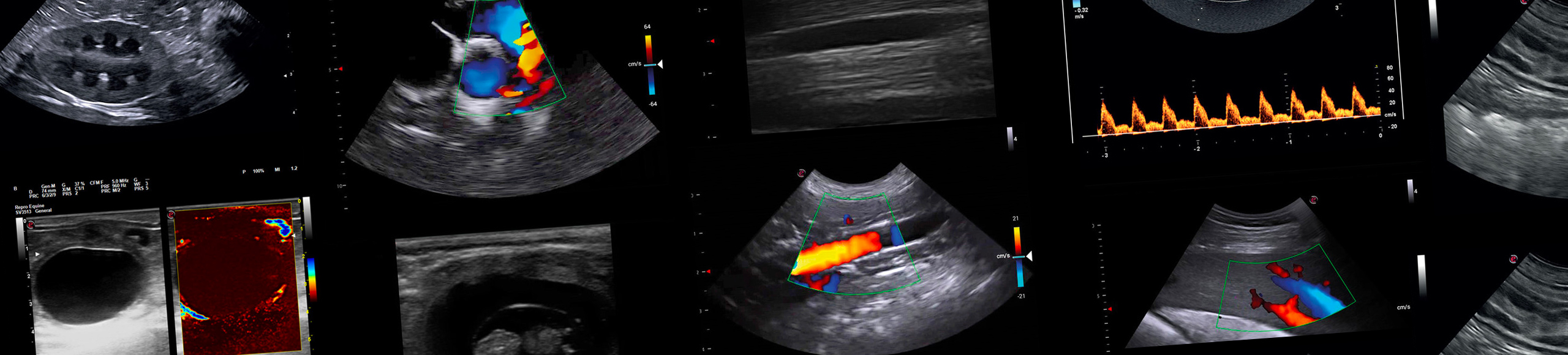 Ultrasound clinical images
