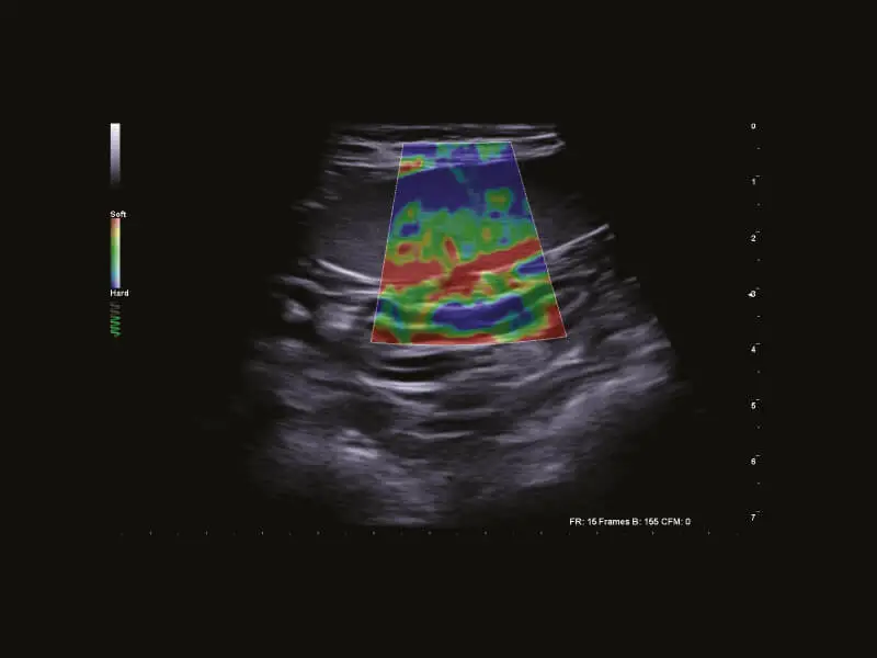 MyLab™Omega eXP VET - Dog - spleen elastosonography with ElaXto