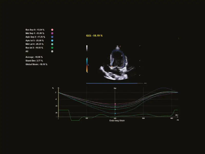 MyLab™Omega eXP VET - Dog - heart wall motion study with XStrain™