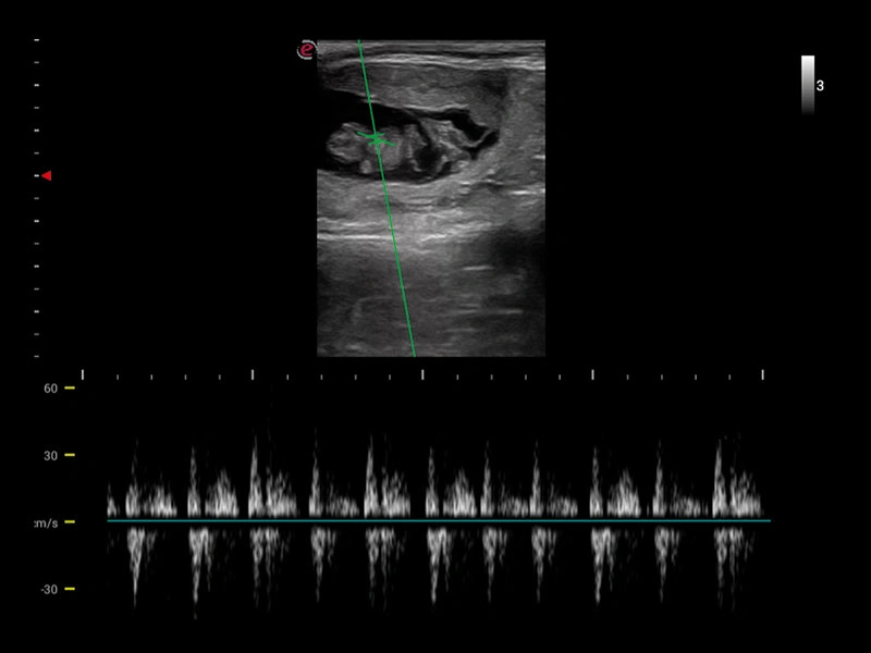 MyLab™X1VET - Bovine - fetus heartbeat