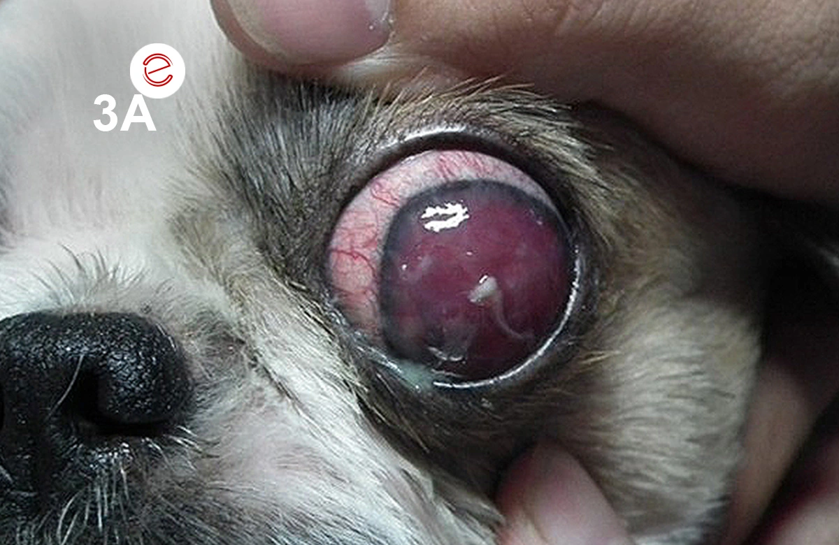 Figure 3A: Hyphema and anterior uveitis were found in the left eye.