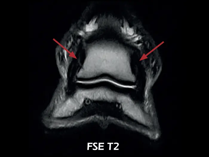 O-scan VET - Lesion of the collateral ligaments of the coffin joint 01