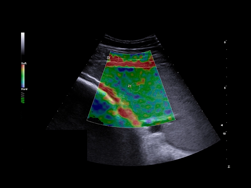 Equine clinical image - spleen stiffness assessment with QElaxto