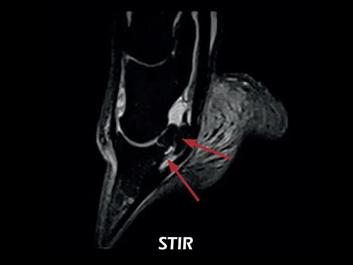 O-scan VET - Lesion of the collateral ligaments of the coffin joint 03