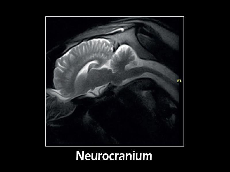 G-scan equine - Neuro 01