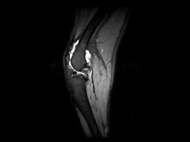 Vet-MR Grande - VG dog GE stir knee acl fracture 2