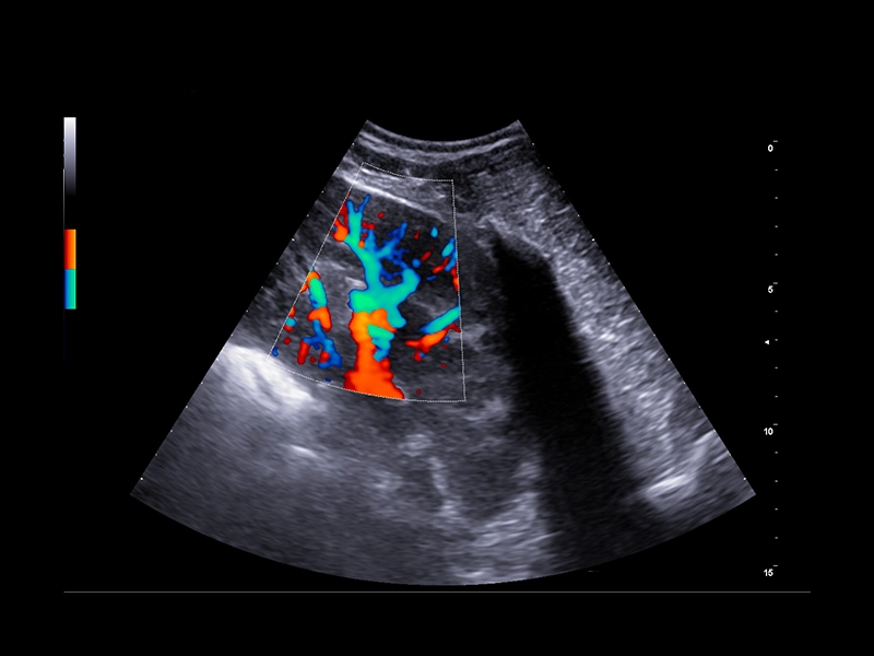 Equine clinical image - equine kidney vascularization with directional power doppler