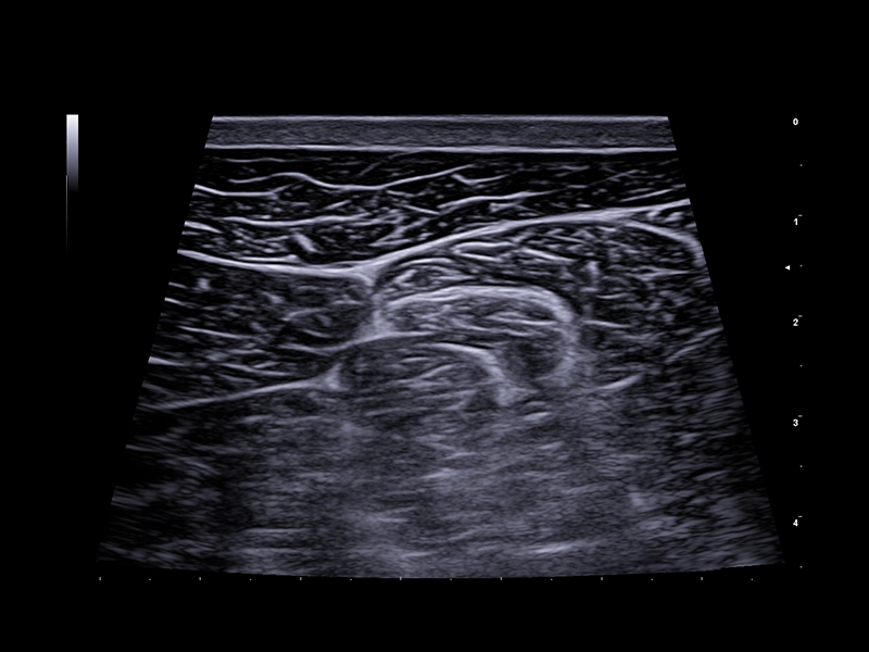 Equine clinical image - trapezoidal view with TPV