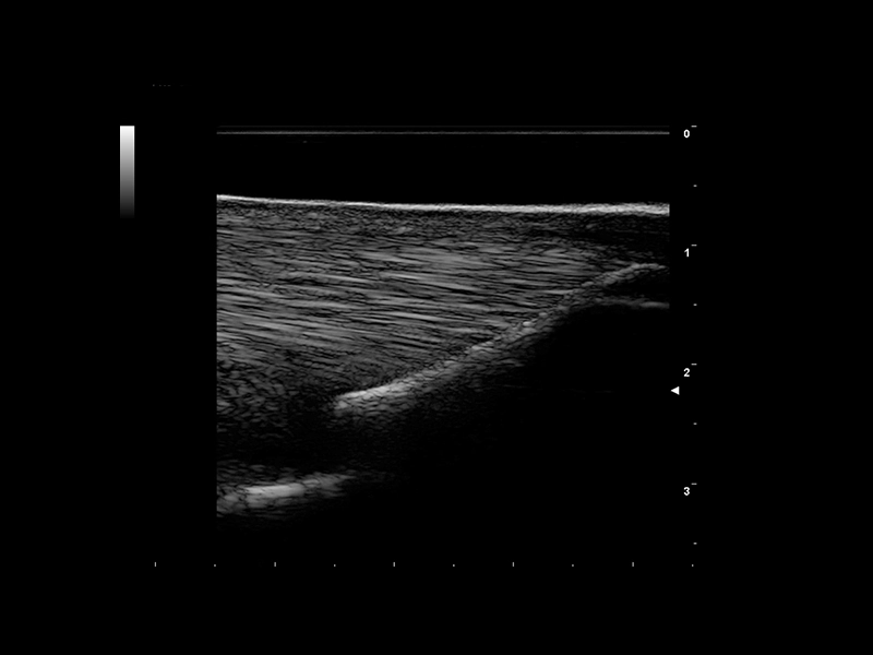 Equine clinical image - tendon 9