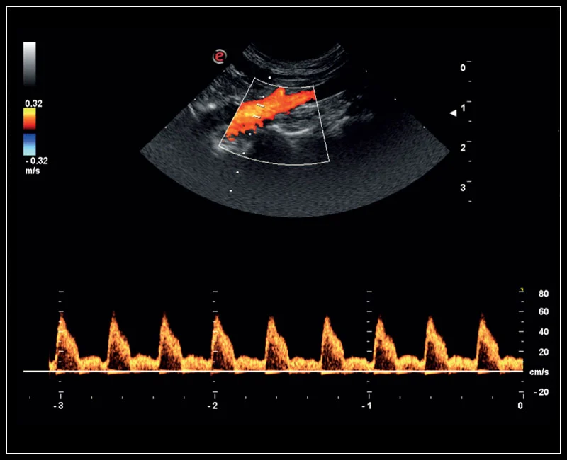 MyLab™X5VET - Cat - artery flow with PW