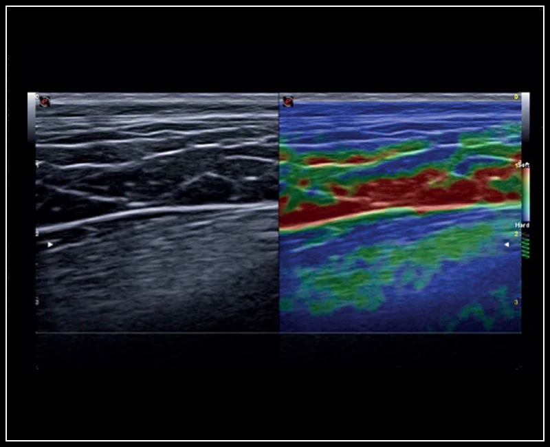 MyLab™X8VET - Dog - leg muscles assessment with ElaXto