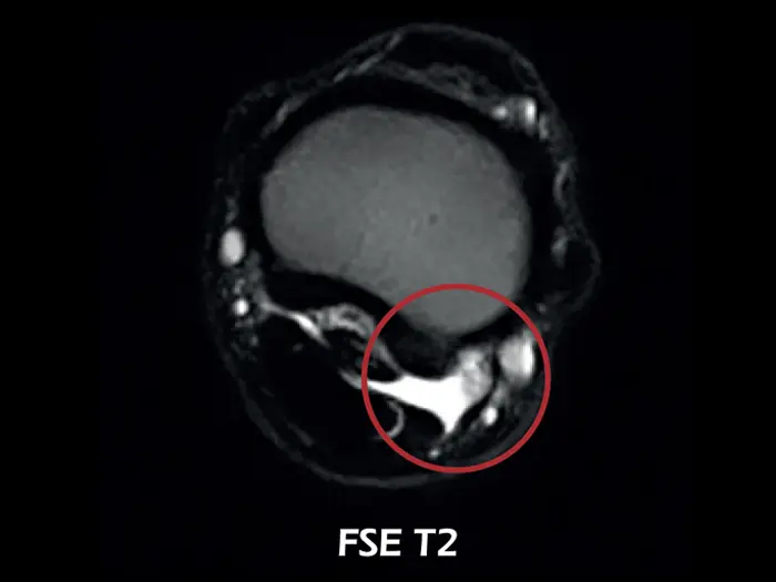 O-scan VET - Fetlock Arthropathy 04