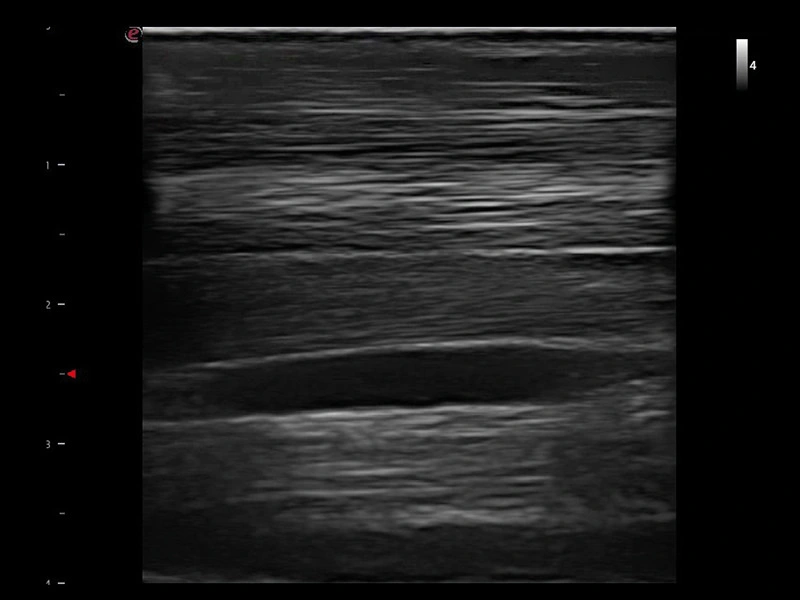 MyLab™X1VET - Equine - tendon longitudinal view