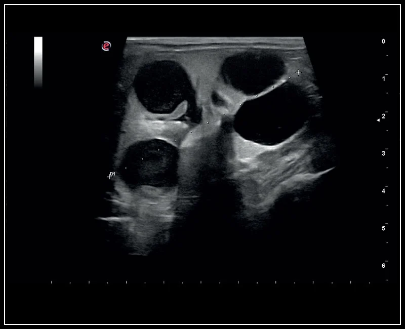 MyLab™Omega VET - Dog - hepatic cysts