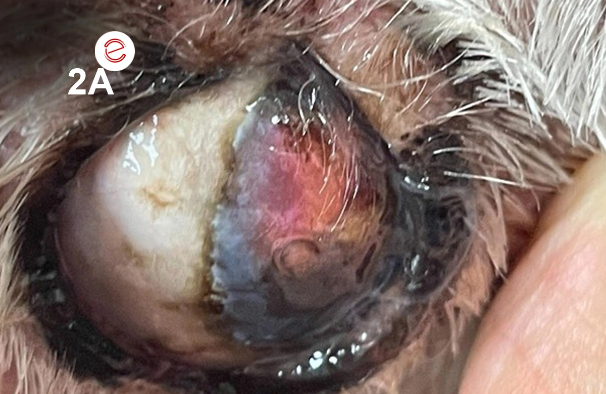 Figure 2A: Phthisis bulbi and complete blindness in the right eye.