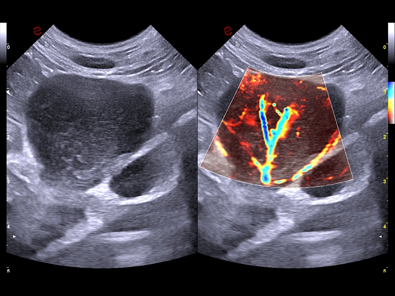 MyLab™FOX - Dog - aberrant vascularization of a lymph node in a dog affected by lymphoma