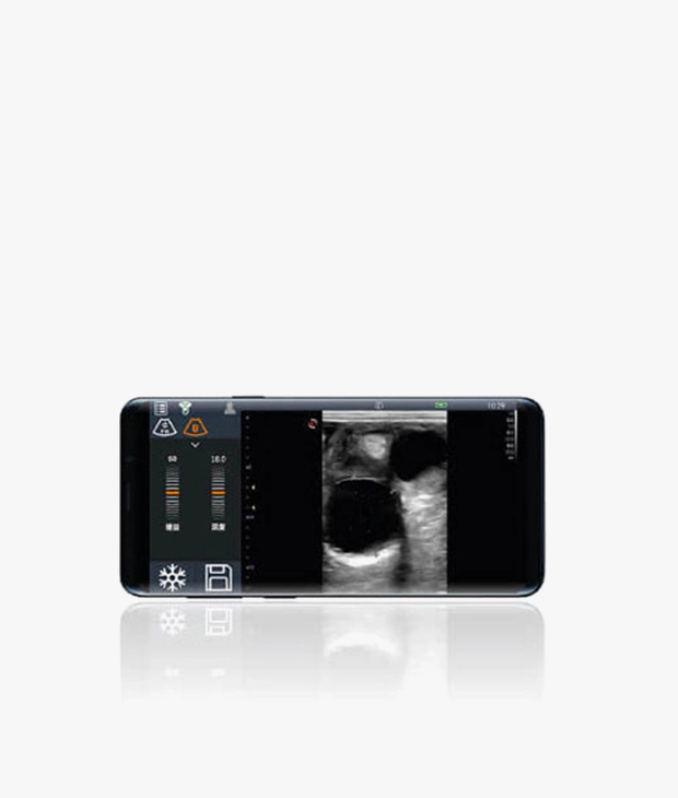 MyLab™TringaVET ultra-portable ultrasound system