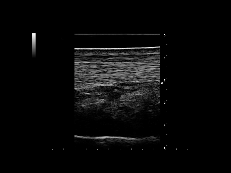 Equine clinical image - tendon 7