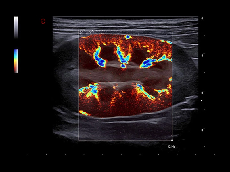 MyLab™X90VET - Dog - kidney vascularization with microV