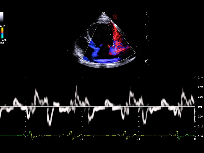 MyLab™FOX - Dog - heart wall motion study with TVM