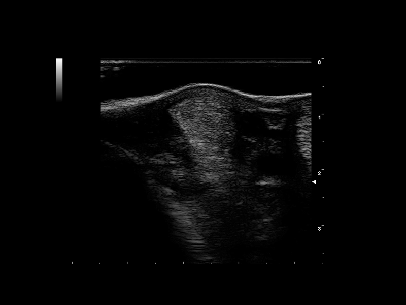 Equine clinical image - tendon 8