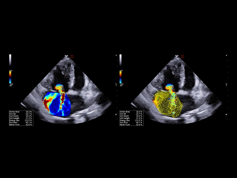 MyLab™X90VET - Dog - heart vortes assessment with HyperDoppler