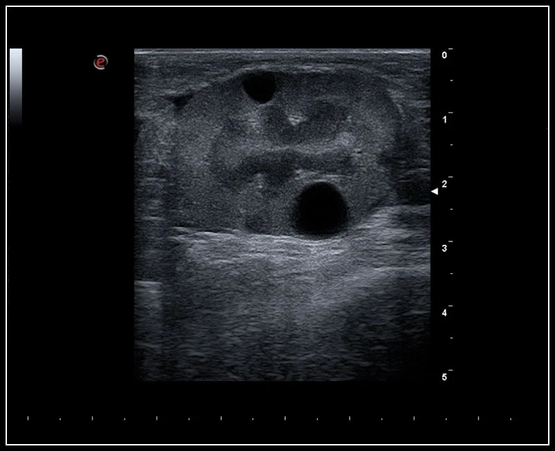 MyLab™X5VET - Cat - kidney cysts