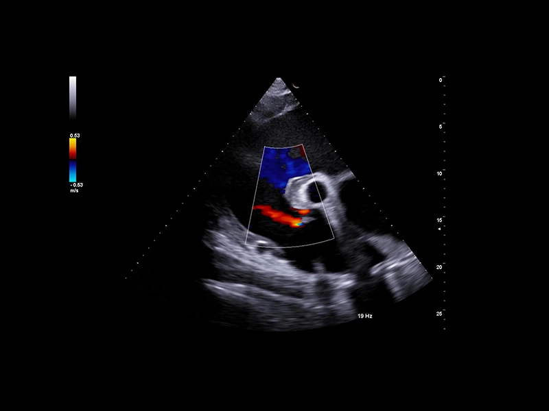 Equine clinical image -clip CFM short axis view frame at 0m 4s