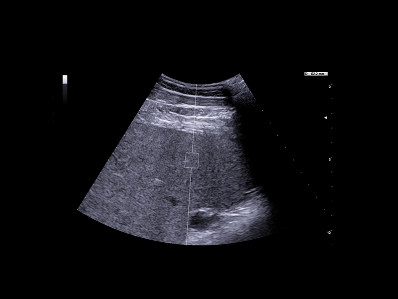 Equine clinical image - spleen stiffness quantification with QElaxto