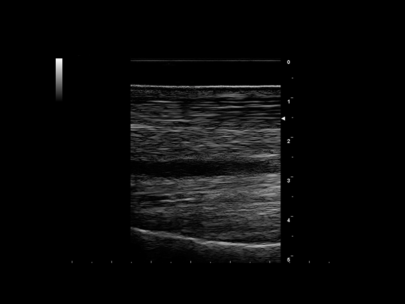 Equine clinical image - tendon 3