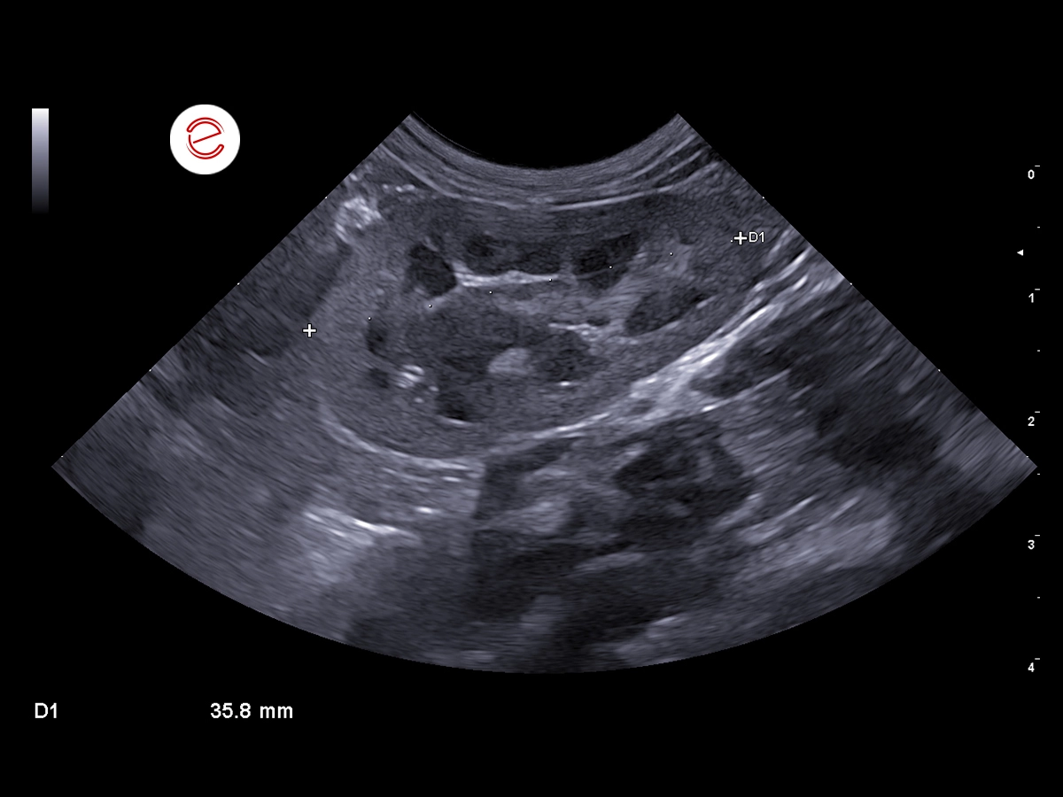 Left longitudinal scan.