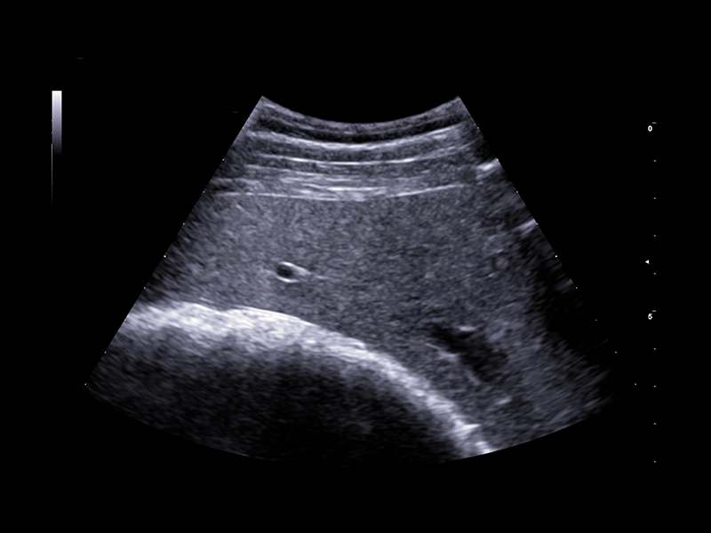 Equine clinical image - equine liver