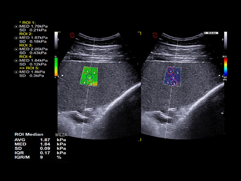 MyLab™X90VET - Equine - spleen stiffness assessment with QElaXto 2D