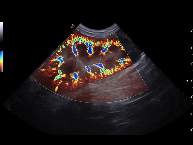 MyLab™X75VET - Dog - kidney vascularization with microV