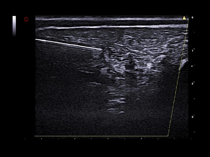 MyLab™X90VET - Dog - needle enhancement