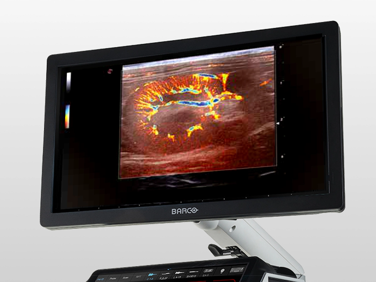 Ultrasound clinical images