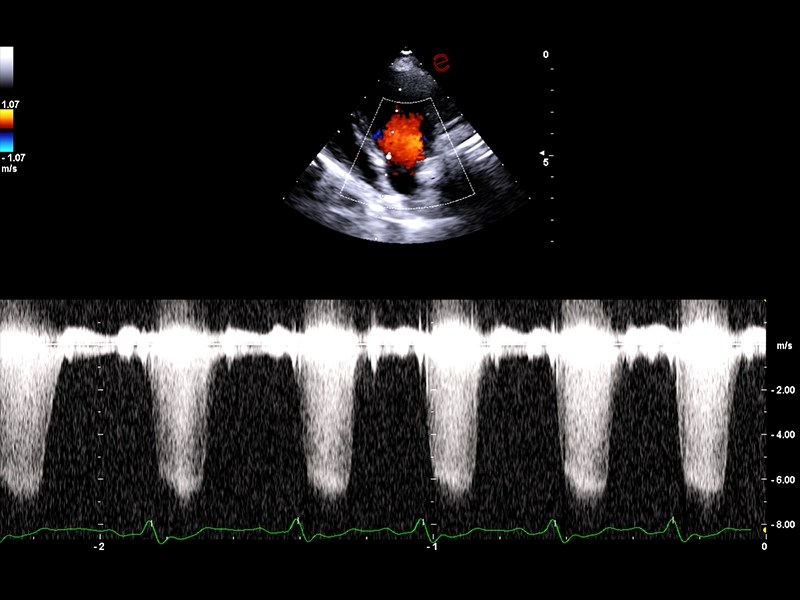 MyLab™FOX - Dog - mitral valve flow with CW