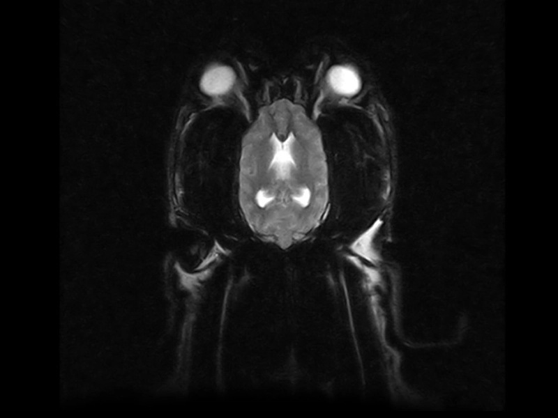 Vet-MR Grande - VG dog FSE T2 coronal cerebellar hemorrhagichinfarction